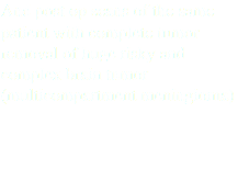 And post op scans of the same patient with complete tumor removal of huge risky and complex brain tumor (multicompartment meningioma)